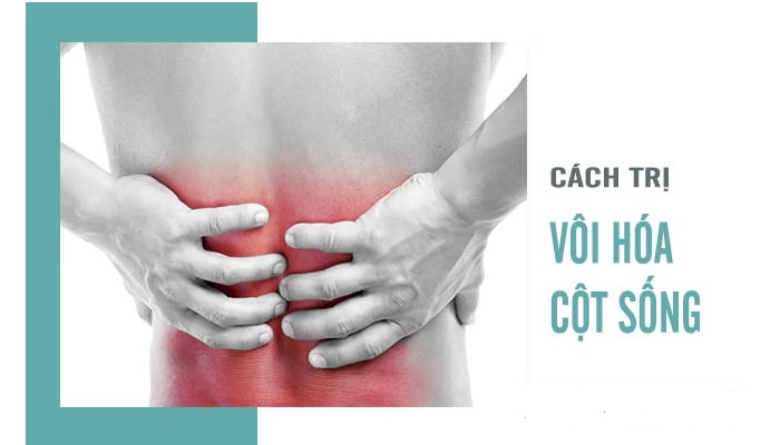 cách chữa Vôi hóa cột sống