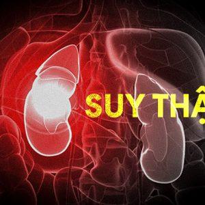 suy than 300x300 1 1
