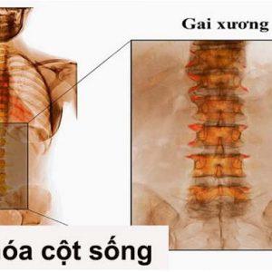 voi hoa cot song 300x300 1 1