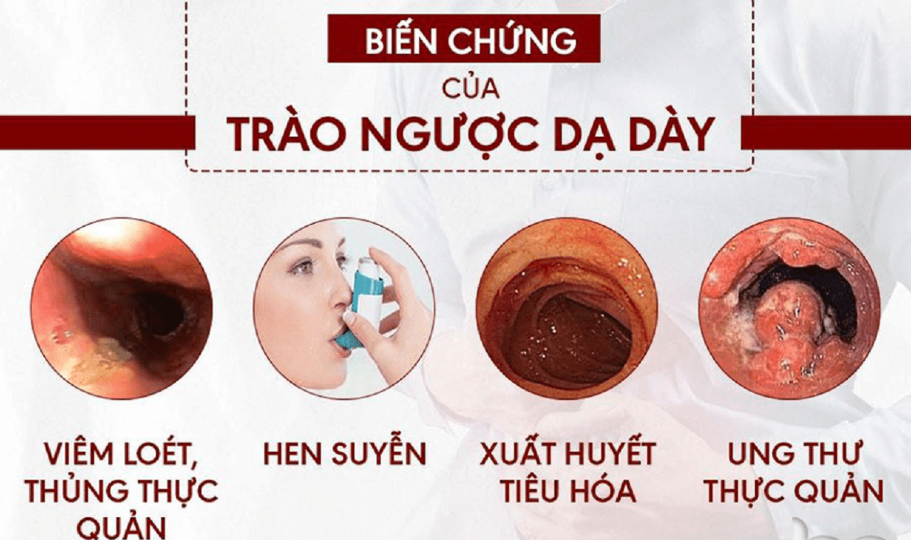 Đừng chủ quan: Biến chứng của trào ngược dạ dày | TCI Hospital