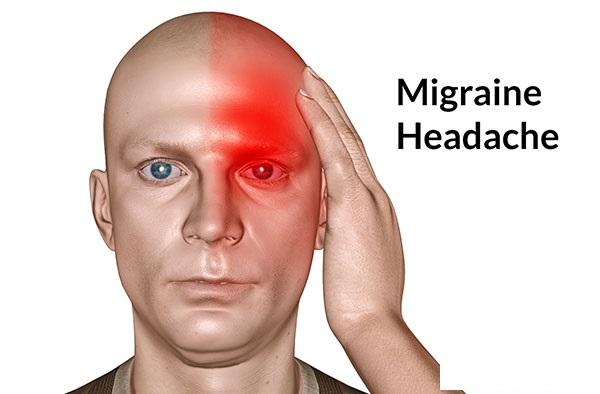 benh-dau-dau-migraine-la-gi