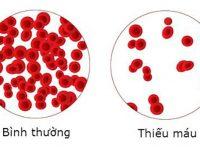 thieu mau do thieu sat 200x150 1