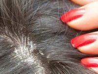 thuoc chua va dieu tri nam da dau 200x150 1