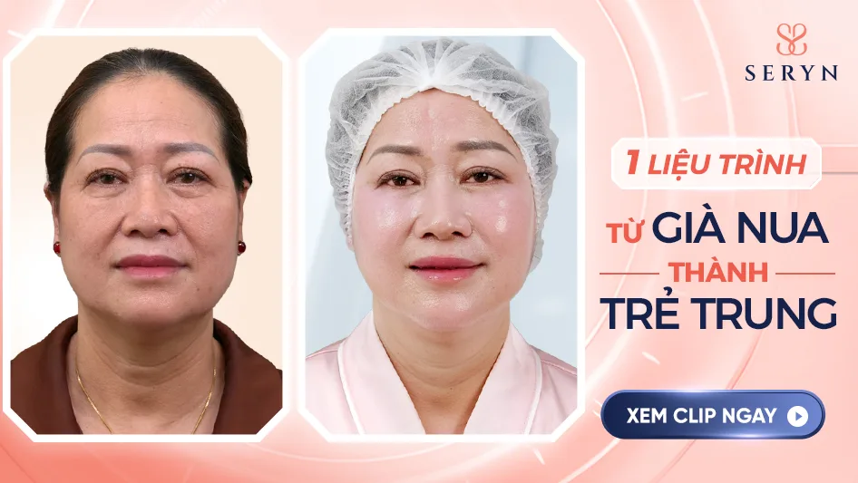 Nguyên tắc xóa nếp nhăn ở gò má tự nhiên, không đơ cứng Công nghệ xóa nếp nhăn ở gò má, trẻ hóa toàn mặt SERA CORE