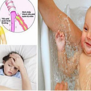 Trẻ bị viêm phế quản có tắm được không