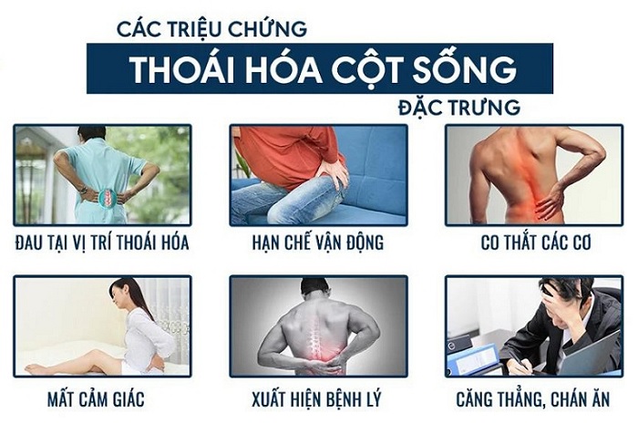 Triệu chứng thoái hóa cột sống