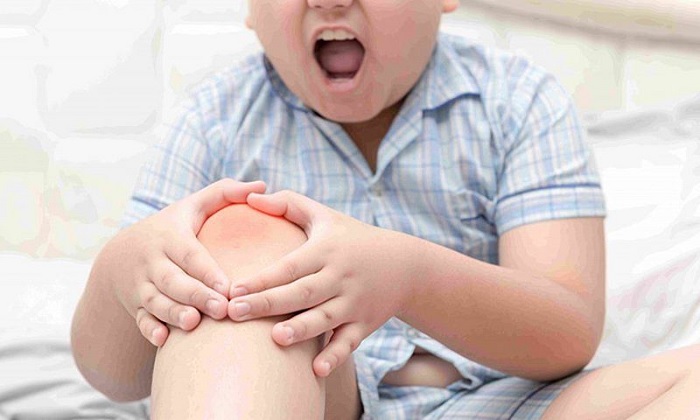 Viêm khớp dạng thấp ở trẻ em