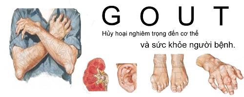 1 benh gout