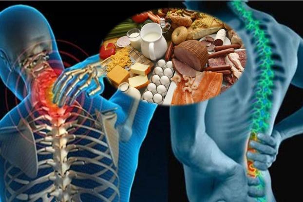 Bị gai cột sống nên ăn gì và kiêng gì cho nhanh khỏi?