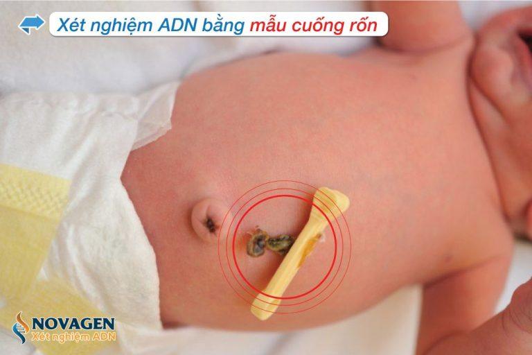 Khi nào bệnh viện yêu cầu xét nghiệm ADN trong hồ sơ điều trị? cuong ron